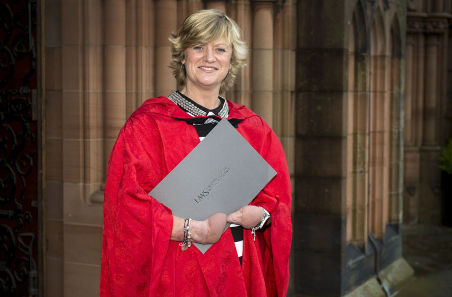 17/11/16 PAISLEY Corinne Hutton, the founder of the charity, Finding Your Feet, which supports people affected by amputation or limb difference, receives her Honorary Doctorate from the University of the West of Scotland (UWS) at its graduation ceremony on at Thomas Coats Memorial Baptist Church in Paisley.